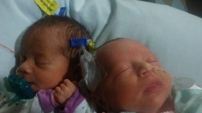 Woman in Kansas City gives birth to three sets of twins